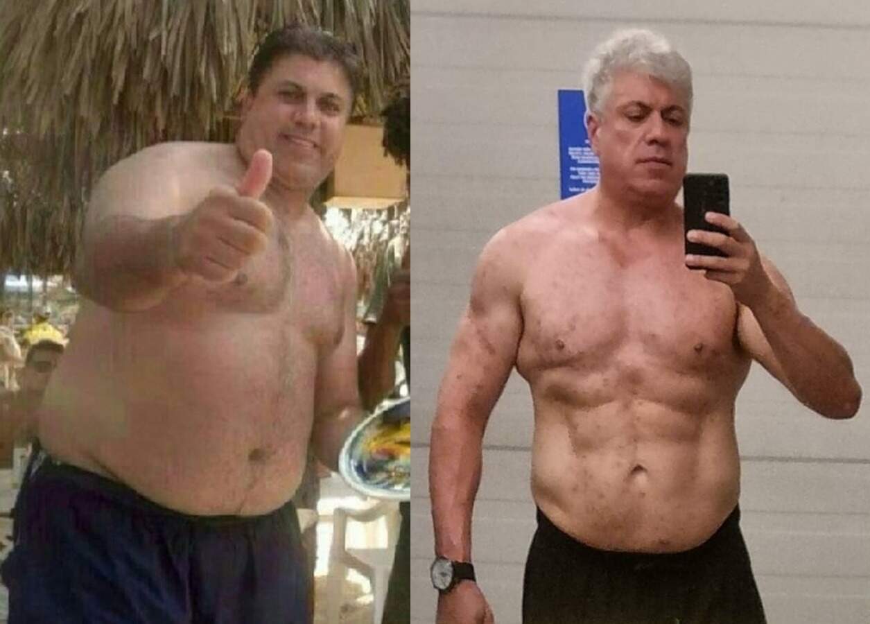 Resultado Mounjaro 4